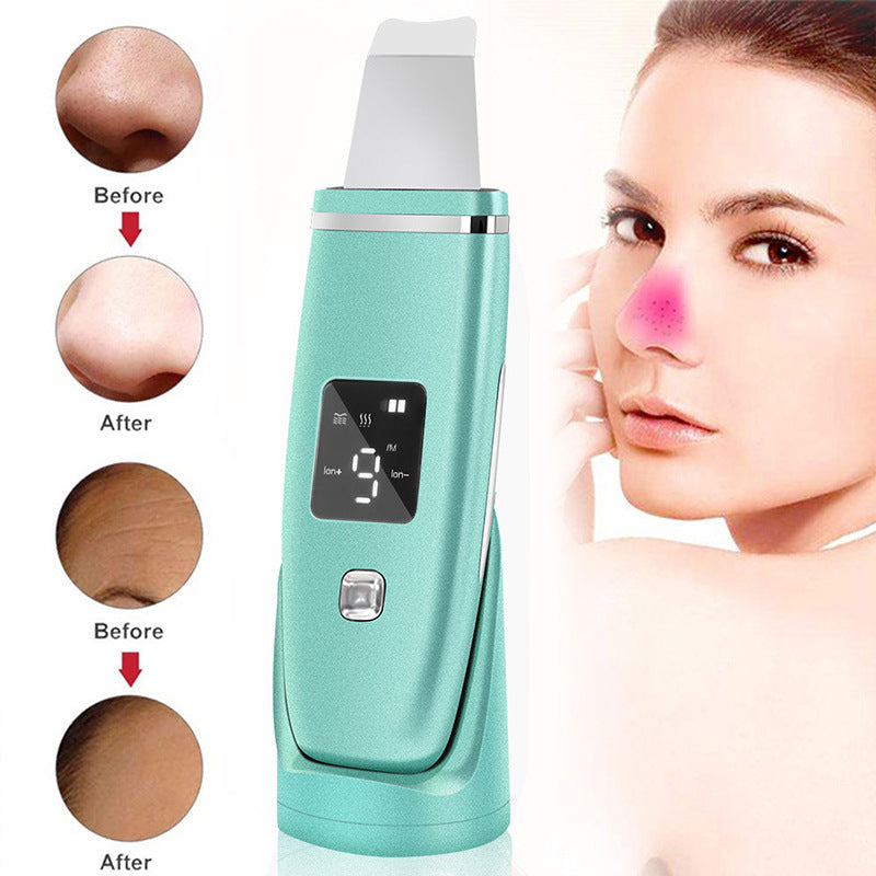 Ultrasonic Blackhead Remover - Professional Deep Cleansing Tool